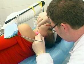 How to get rid of papillomas on your body