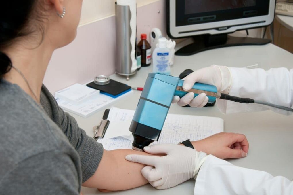 Ways to Treat Body Warts